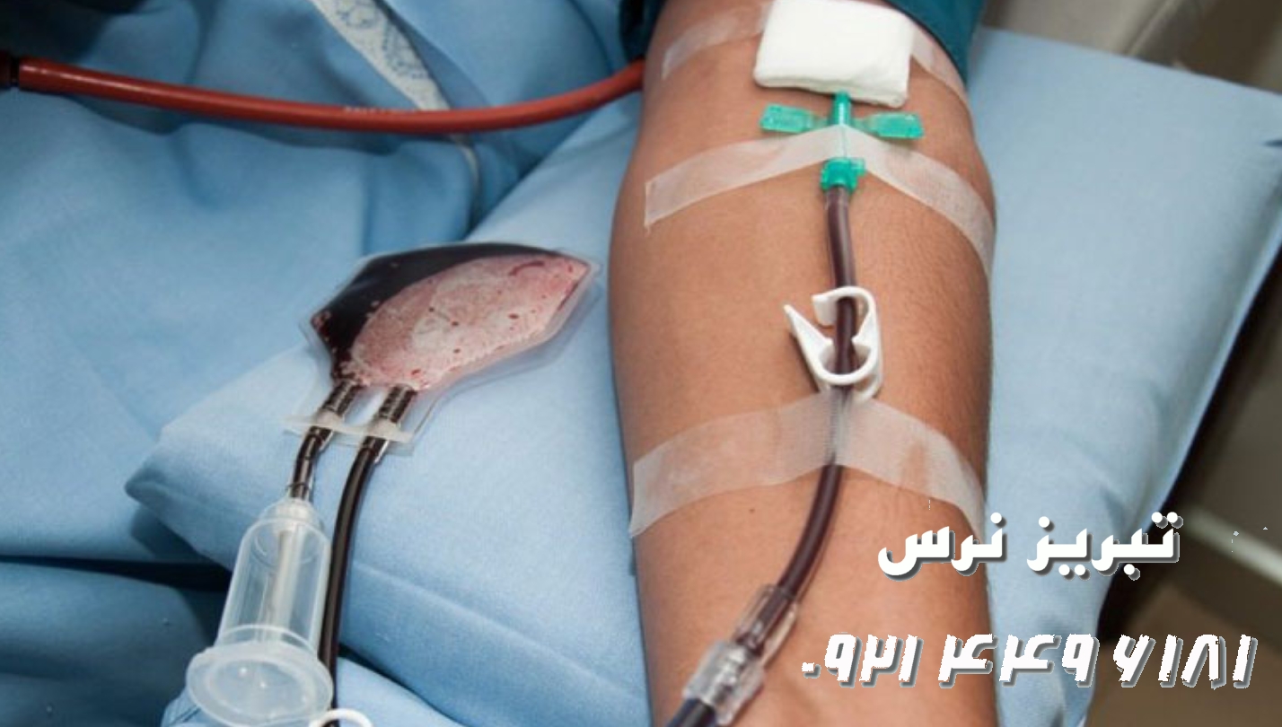 فصد خون چیست، راهنمای جامع فواید فصد خون