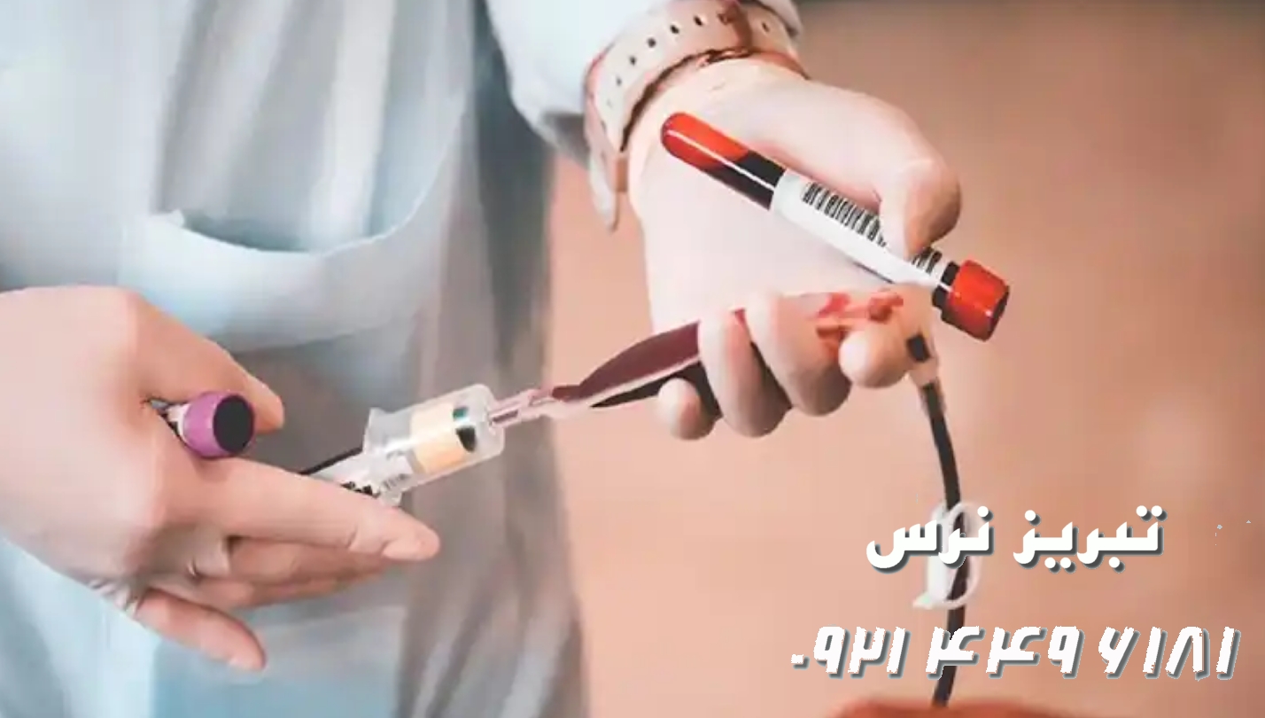 خطرات فصد خون که پزشکان می‌ترسند بگویند تبریز 09214496181