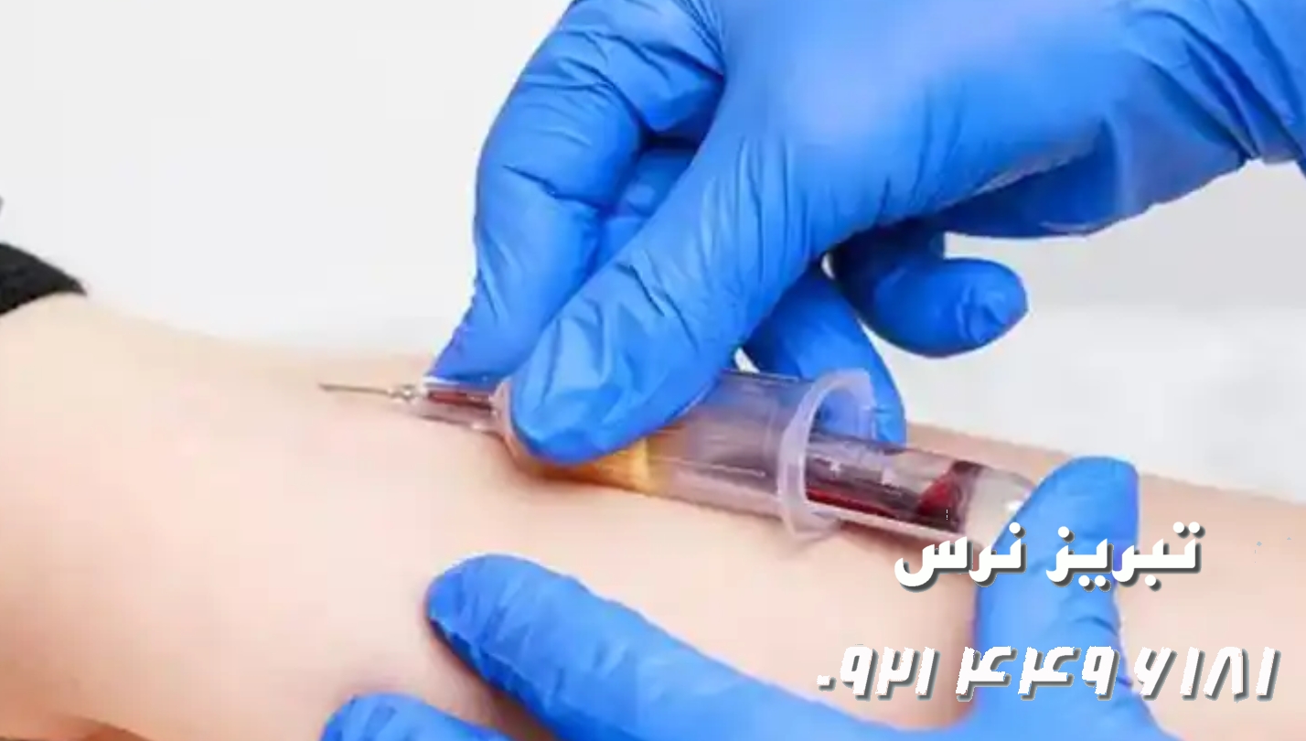 بیماری هایی که با فصد خون درمان می‌شوند تبریز 09214496181