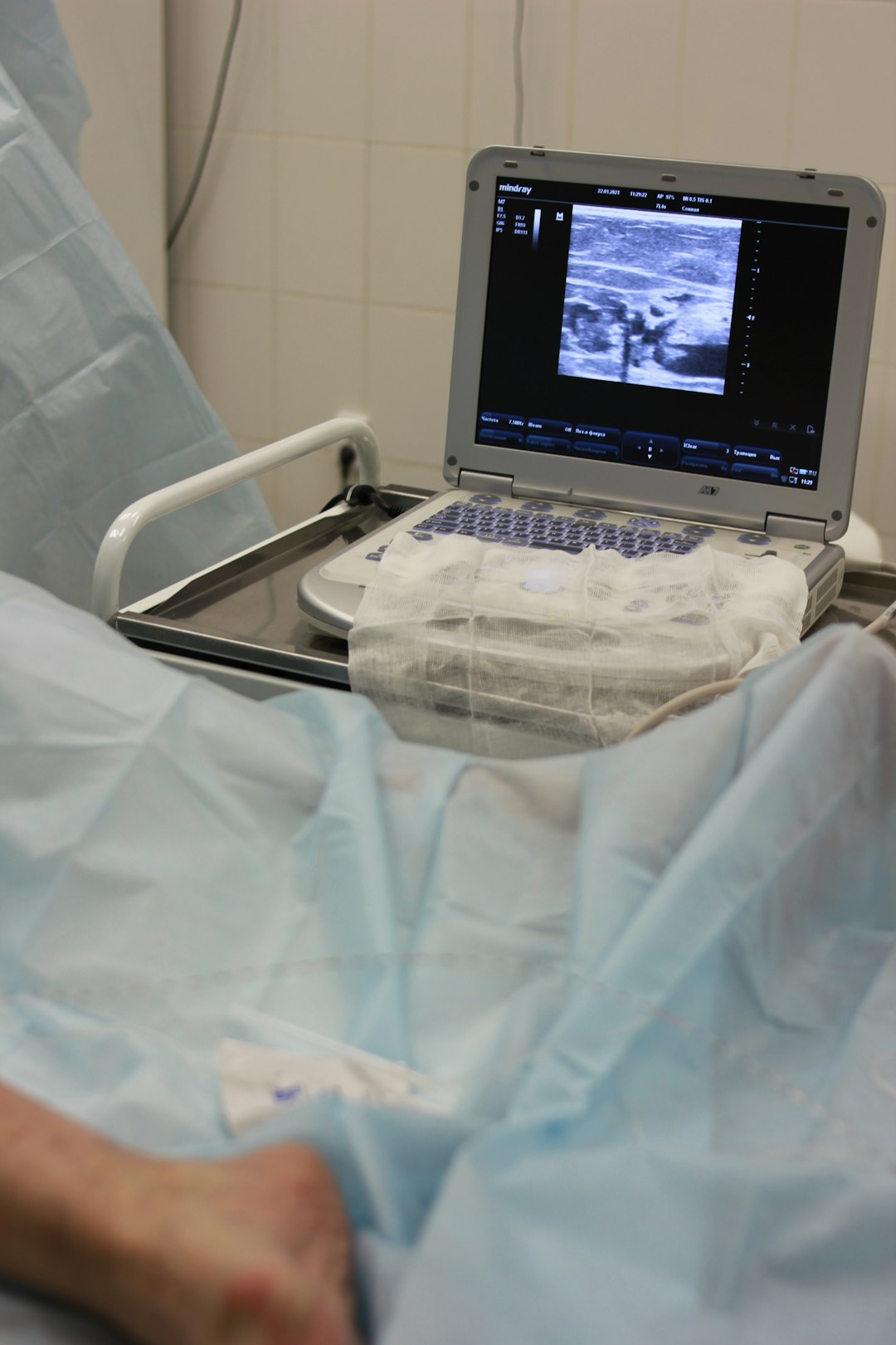 a laptop computer sitting on top of a hospital bed