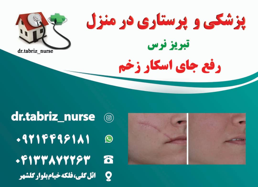 گالری 1